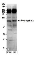 Polycystin-2 Antibody in Western Blot (WB)