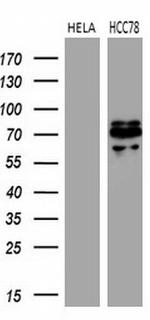 ROS1 Antibody in Western Blot (WB)
