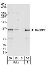 RanBP8 Antibody in Western Blot (WB)