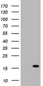 S100A1 Antibody in Western Blot (WB)