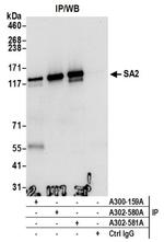SA2 Antibody in Western Blot (WB)