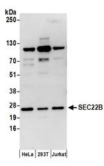 SEC22B Antibody in Western Blot (WB)