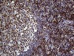 SEMA4D Antibody in Immunohistochemistry (Paraffin) (IHC (P))