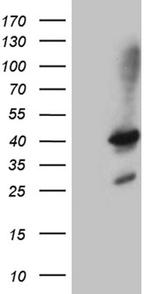 SHARPIN Antibody in Western Blot (WB)