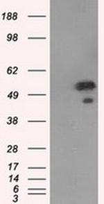 SHC1 Antibody in Western Blot (WB)