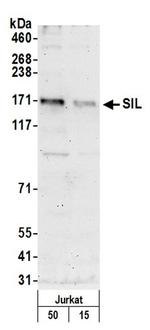 SIL Antibody in Western Blot (WB)