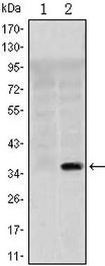 SLC22A1 Antibody in Western Blot (WB)