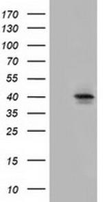 SLC30A3 Antibody in Western Blot (WB)