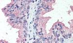 ZIP14 Antibody in Immunohistochemistry (Paraffin) (IHC (P))