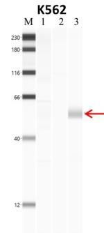 Phospho-SMAD2 (Ser465, Ser467) Antibody in Immunoprecipitation (IP)