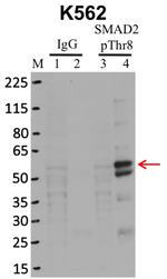 Phospho-SMAD2 (Thr8) Antibody in RNA Immunoprecipitation (RIP)