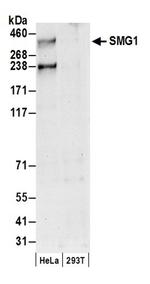 SMG1 Antibody in Western Blot (WB)