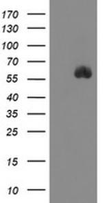 SPINT1 Antibody in Western Blot (WB)