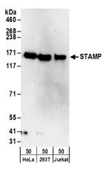 STAMP Antibody in Western Blot (WB)