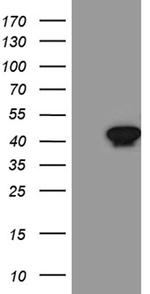 Septin 3 Antibody in Western Blot (WB)