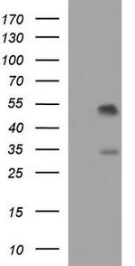 PIG3 Antibody in Western Blot (WB)