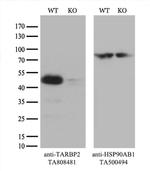 TARBP2 Antibody