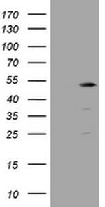 TBC1D13 Antibody in Western Blot (WB)