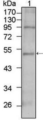 TBX5 Antibody in Western Blot (WB)