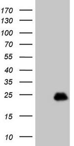 TCAP Antibody in Western Blot (WB)