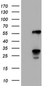 TCP11L2 Antibody in Western Blot (WB)