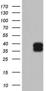 TFPI2 Antibody in Western Blot (WB)