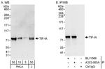 TIF-IA Antibody in Western Blot (WB)