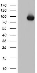 TLK2 Antibody in Western Blot (WB)