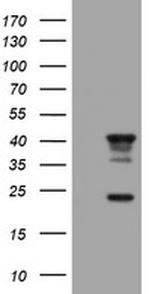 TMEM173 Antibody in Western Blot (WB)