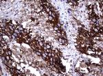 TNFRSF8 Antibody in Immunohistochemistry (Paraffin) (IHC (P))