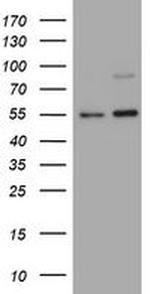 TNFRSF8 Antibody in Western Blot (WB)