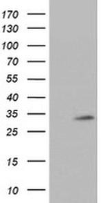 TPSG1 Antibody in Western Blot (WB)