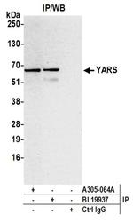 YARS/Tyrosyl-tRNA Synthetase/TYRRS Antibody in Western Blot (WB)