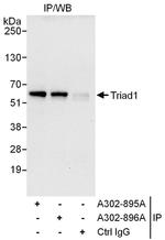 Triad1 Antibody in Immunoprecipitation (IP)