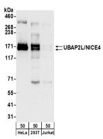 UBAP2L/NICE4 Antibody in Western Blot (WB)