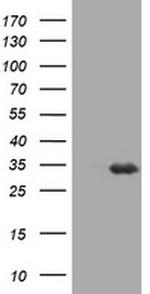 USP44 Antibody in Western Blot (WB)