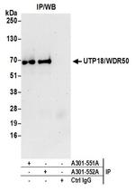 UTP18/WDR50 Antibody in Immunoprecipitation (IP)