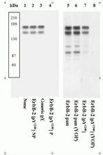 Phospho-ErbB2 (HER-2) (Tyr1248) Antibody in Western Blot (WB)