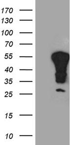 YBX2 Antibody in Western Blot (WB)