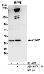 ZCRB1 Antibody in Western Blot (WB)