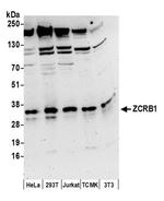 ZCRB1 Antibody in Western Blot (WB)