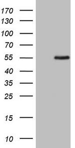 ZNF200 Antibody in Western Blot (WB)