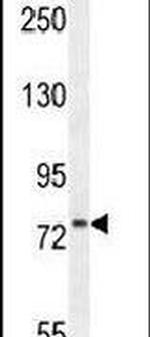 ZNF611 Antibody in Western Blot (WB)