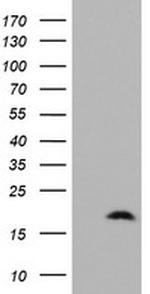 ZNRD1 Antibody in Western Blot (WB)