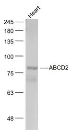 ABCD2 Antibody in Western Blot (WB)