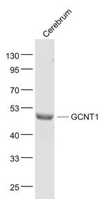 GCNT1 Antibody in Western Blot (WB)