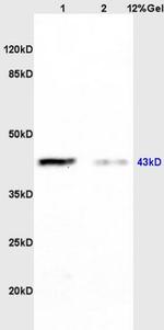 CK 2 alpha Antibody in Western Blot (WB)