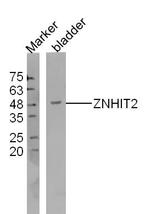 ZNHIT2 Antibody in Western Blot (WB)