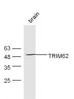 TRIM62 Antibody in Western Blot (WB)