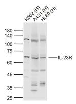 IL-23R Antibody in Western Blot (WB)
